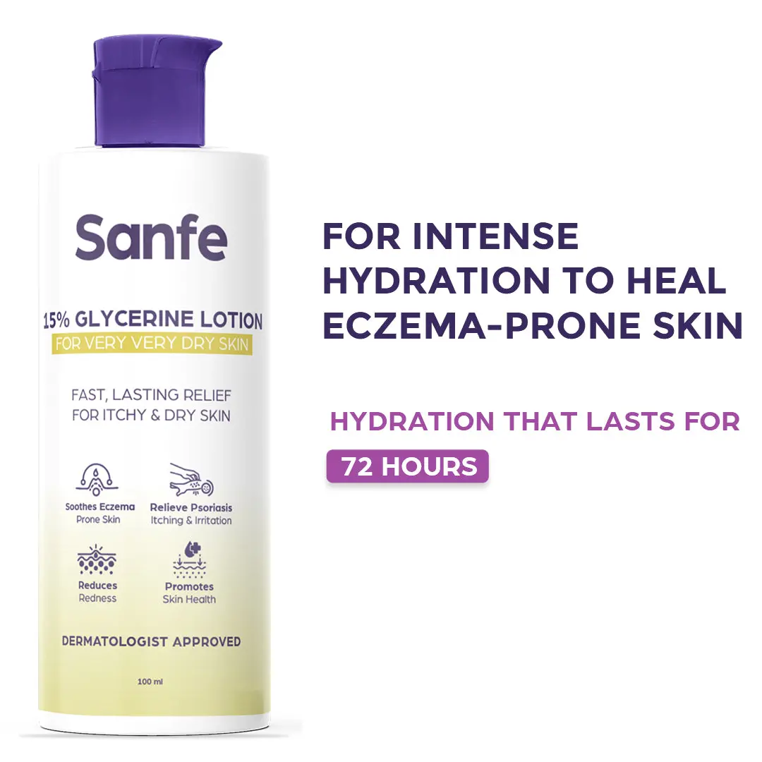 Sanfe Eczema Lotion - 100Ml 1